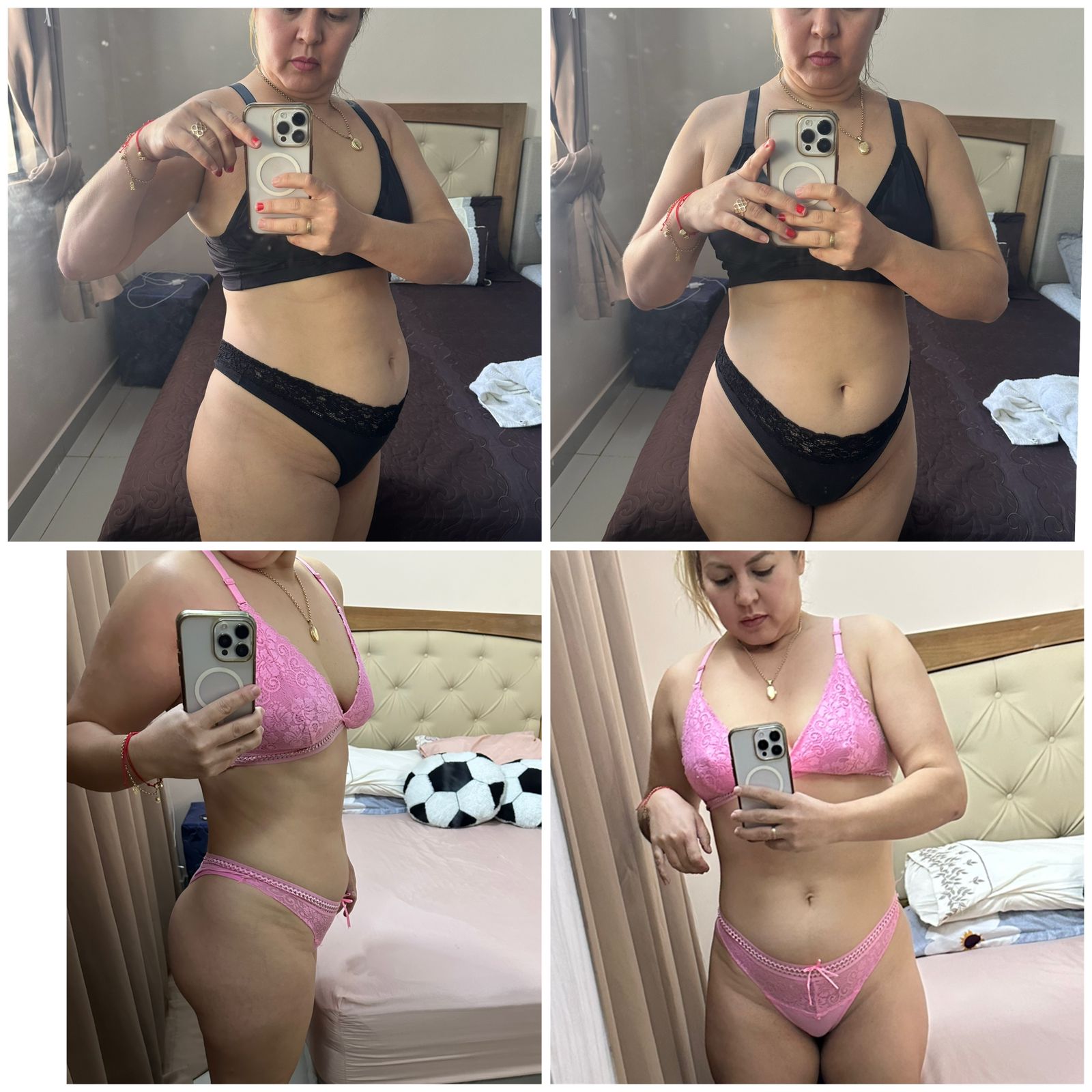 Antes y después — transformación real 5