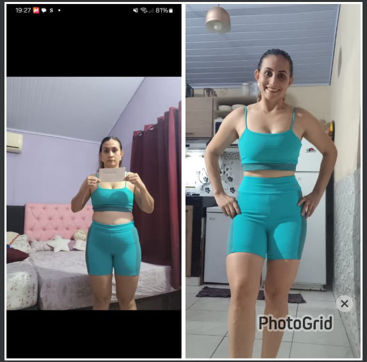 Antes y después — transformación real 7