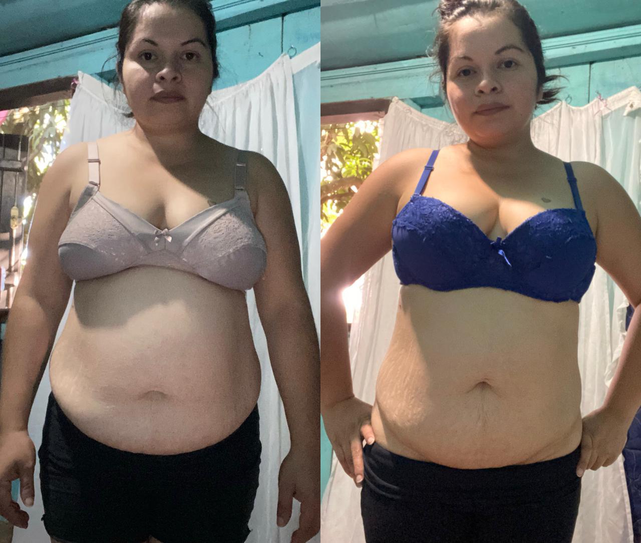 Antes y después — transformación real 10